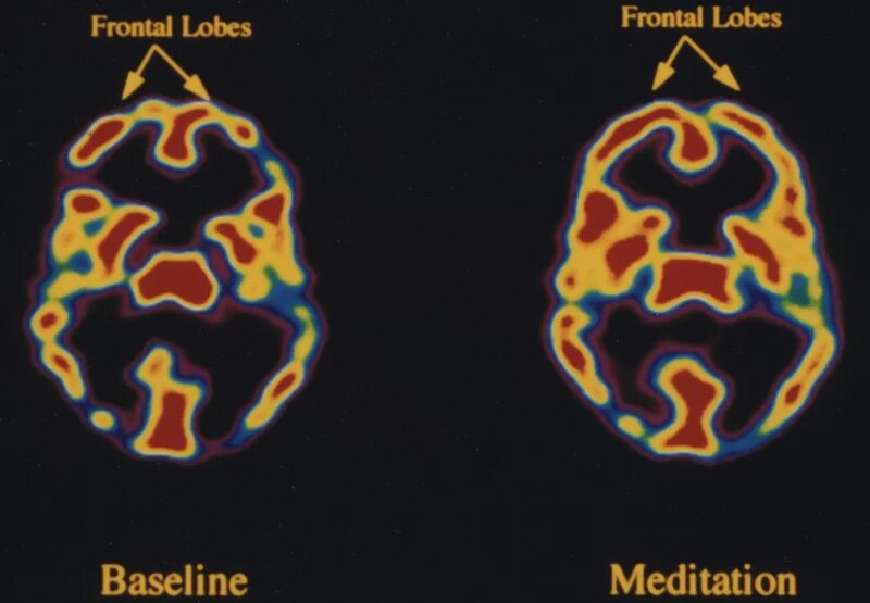 meditation research
meditation studies 